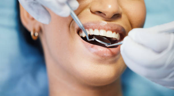 Best Broken or Cracked Tooth Emergency Dentist in Enumclaw, WA